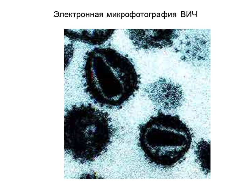 Электронная микрофотография ВИЧ